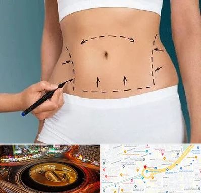 دکتر طب سنتی برای لاغری در میدان ولیعصر 