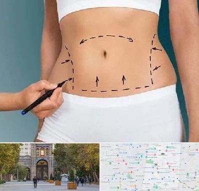 دکتر طب سنتی برای لاغری در منطقه 12 تهران 