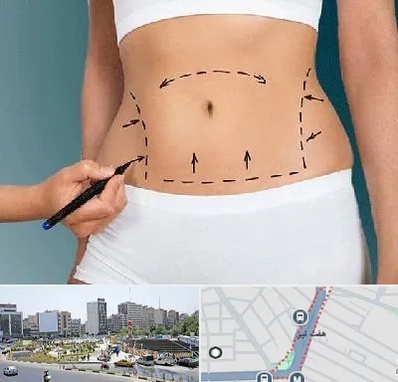 دکتر طب سنتی برای لاغری در هفت تیر