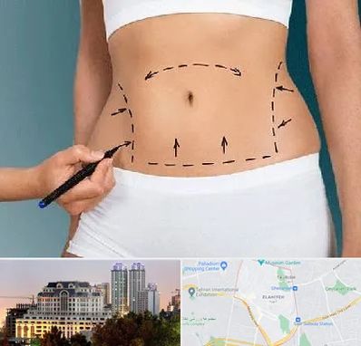 دکتر طب سنتی برای لاغری در فرشته 