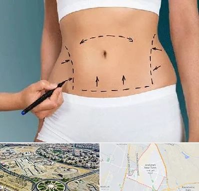 دکتر طب سنتی برای لاغری در اندیشه