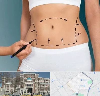 دکتر طب سنتی برای لاغری در طلاب مشهد 