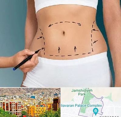 دکتر طب سنتی برای لاغری در نیاوران 