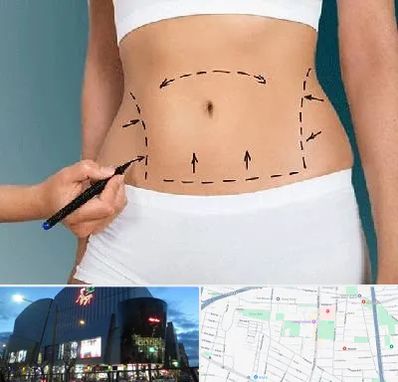 دکتر طب سنتی برای لاغری در بلوار اباذر