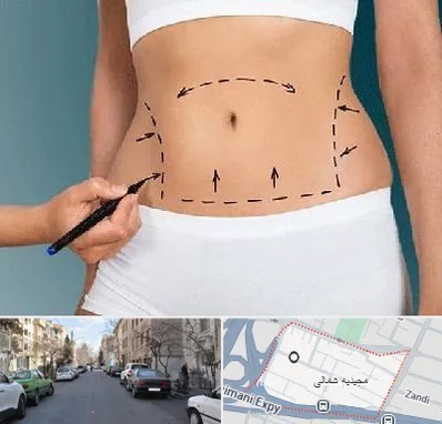 دکتر طب سنتی برای لاغری در مجیدیه شمالی