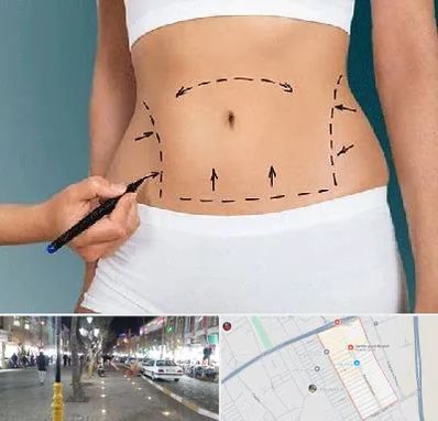 دکتر طب سنتی برای لاغری در باغ فیض اسلامشهر 