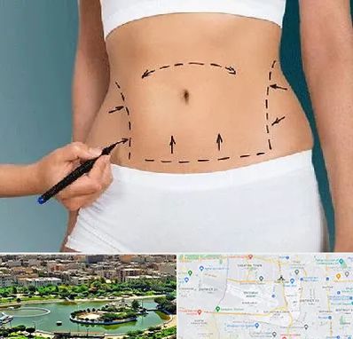 دکتر طب سنتی برای لاغری در منطقه 9 تهران 