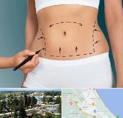 دکتر طب سنتی برای لاغری در رودسر