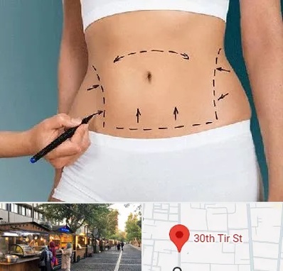 دکتر طب سنتی برای لاغری در سی تیر