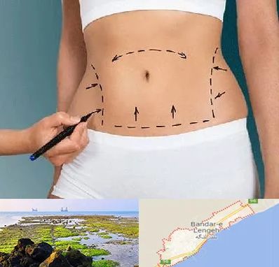 دکتر طب سنتی برای لاغری در بندرلنگه
