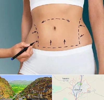 دکتر طب سنتی برای لاغری در کامیاران