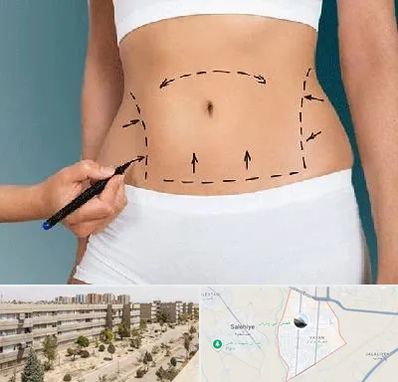 دکتر طب سنتی برای لاغری در واوان اسلامشهر 