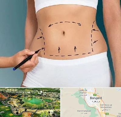 دکتر طب سنتی برای لاغری در بروجرد
