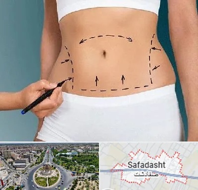 دکتر طب سنتی برای لاغری در صفادشت