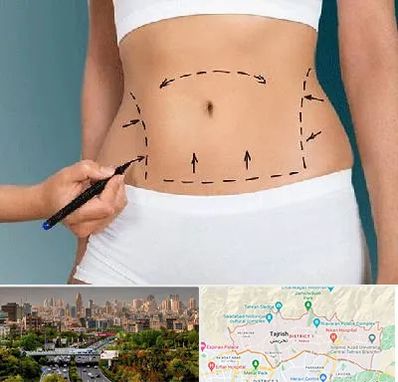 دکتر طب سنتی برای لاغری در منطقه 1 تهران 