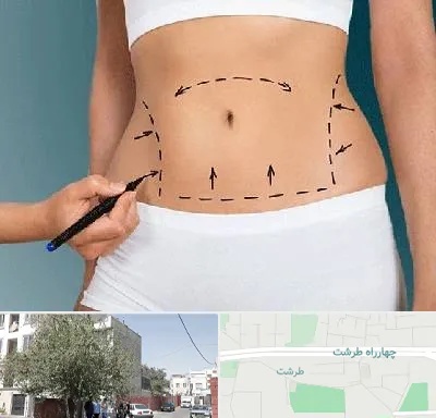 دکتر طب سنتی برای لاغری در طرشت