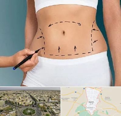 دکتر طب سنتی برای لاغری در قزوین