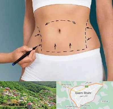 دکتر طب سنتی برای لاغری در قائم شهر
