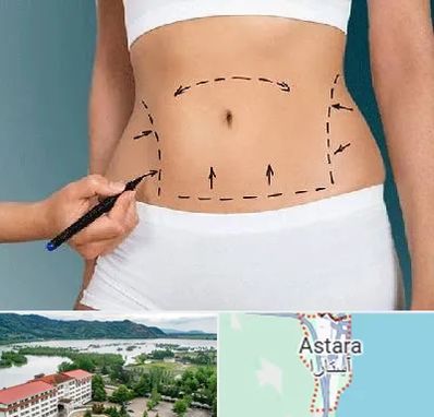 دکتر طب سنتی برای لاغری در آستارا