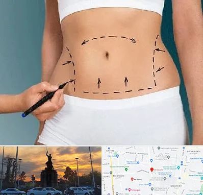 دکتر طب سنتی برای لاغری در میدان حر 