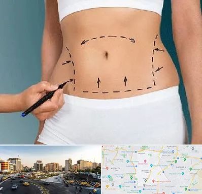 دکتر طب سنتی برای لاغری در منطقه 7 تهران 