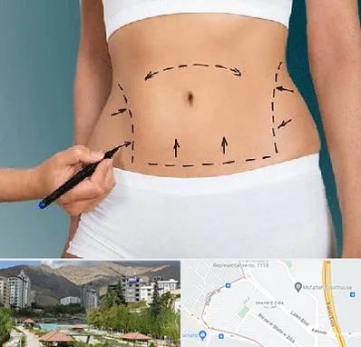 دکتر طب سنتی برای لاغری در شهر زیبا 