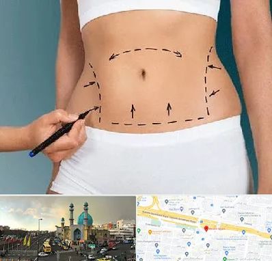 دکتر طب سنتی برای لاغری در رسالت 