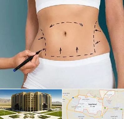 دکتر طب سنتی برای لاغری در نجف آباد
