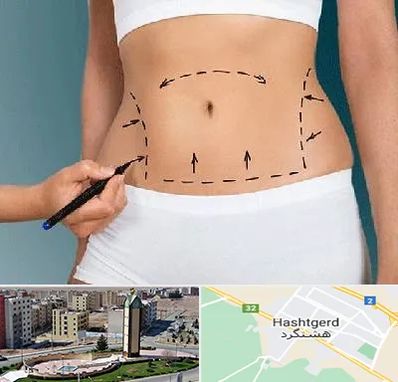 دکتر طب سنتی برای لاغری در هشتگرد