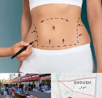 دکتر طب سنتی برای لاغری در شوش