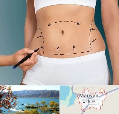 دکتر طب سنتی برای لاغری در مریوان