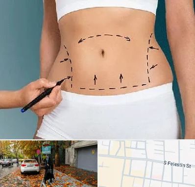 دکتر طب سنتی برای لاغری در خیابان فلسطین