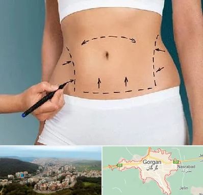 دکتر طب سنتی برای لاغری در گرگان