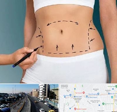 دکتر طب سنتی برای لاغری در پیروزی 