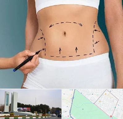 دکتر طب سنتی برای لاغری در بلوار فلسیطین مشهد 