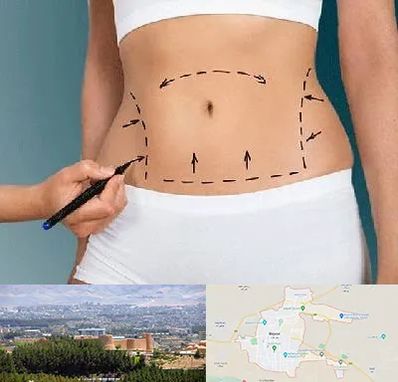 دکتر طب سنتی برای لاغری در بیرجند
