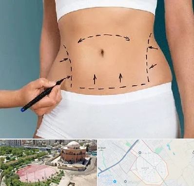 دکتر طب سنتی برای لاغری در گلستان اسلامشهر 