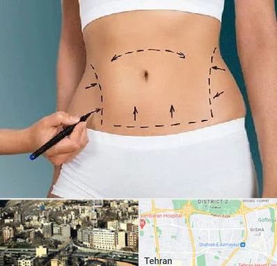 دکتر طب سنتی برای لاغری در مرزداران 