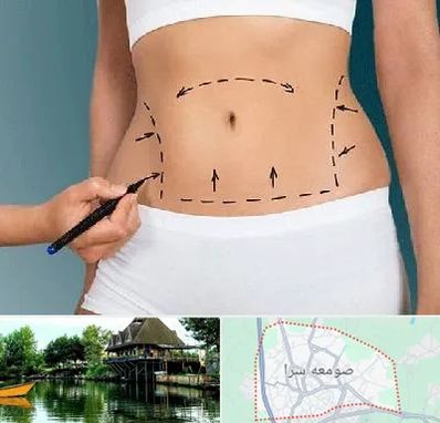 دکتر طب سنتی برای لاغری در صومعه سرا