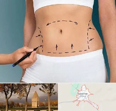 دکتر طب سنتی برای لاغری در تویسرکان
