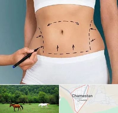 دکتر طب سنتی برای لاغری در چمستان