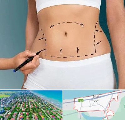 دکتر طب سنتی برای لاغری در نور