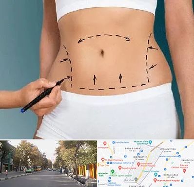 دکتر طب سنتی برای لاغری در شریعتی 