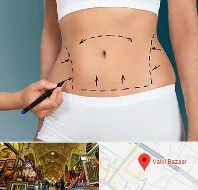 دکتر طب سنتی برای لاغری در بازار وکیل شیراز