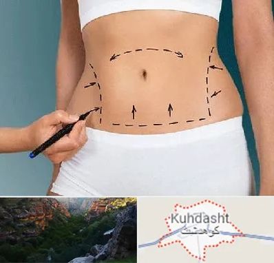 دکتر طب سنتی برای لاغری در کوهدشت