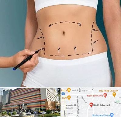 دکتر طب سنتی برای لاغری در سهروردی 