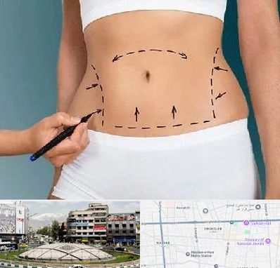 دکتر طب سنتی برای لاغری در مرکز تهران