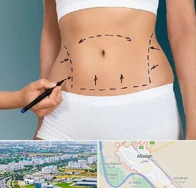 دکتر طب سنتی برای لاغری در آبادان