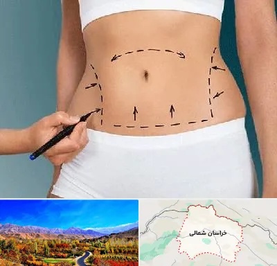 دکتر طب سنتی برای لاغری در خراسان شمالی