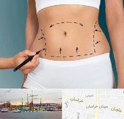 دکتر طب سنتی برای لاغری در میدان خراسان